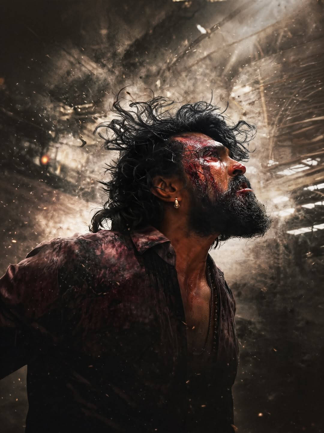 Ram Charan wrist surgery